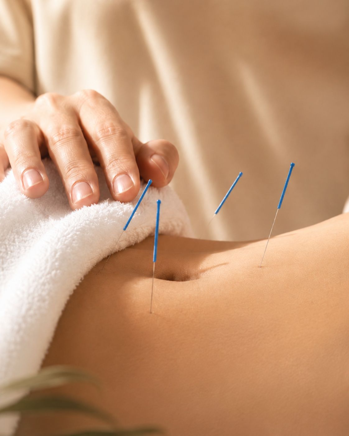 Acupuncture Session